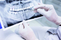 Удаление зубных отложений с помощью ультразвуковой аппаратуры (с одного зуба)